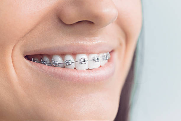 Best Traditional Braces  in Shannondale, WV